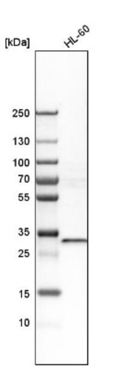 ZNF146 Antibody, Novus Biologicals:Antibodies:Primary Antibodies