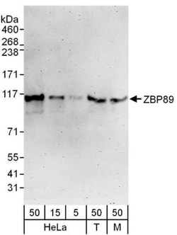 ZNF148 Antibody, Novus Biologicals 0.1mg; Unlabeled:Antibodies, Polyclonal