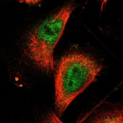 ZNF175 Antibody, Novus Biologicals 25 &mu;L; Unlabeled:Antibodies, Polyclonal