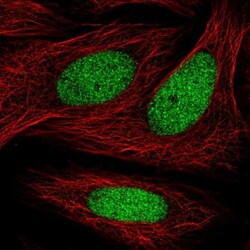 ZNF182 Antibody, Novus Biologicals:Antibodies:Primary Antibodies