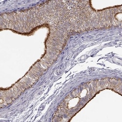 ZNF185 Antibody, Novus Biologicals:Antibodies:Primary Antibodies