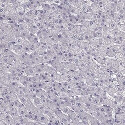 ZNF185 Antibody, Novus Biologicals 25 &mu;L; Unlabeled:Antibodies, Polyclonal