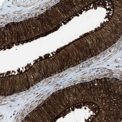 NLRP10/Pynod/NALP10 Antibody, Novus Biologicals:Antibodies:Primary Antibodies