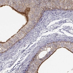 NLRP10/Pynod/NALP10 Antibody, Novus Biologicals:Antibodies:Primary Antibodies
