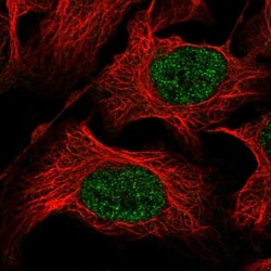 ZNF193 Antibody, Novus Biologicals 25 &mu;L, Unlabeled:Antibodies, Polyclonal