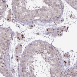 ZNF193 Antibody, Novus Biologicals 25 &mu;L, Unlabeled:Antibodies, Polyclonal