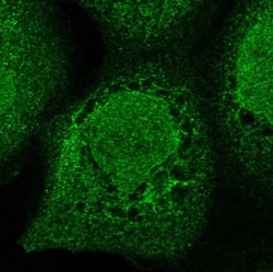ZNF198 Antibody, Novus Biologicals:Antibodies:Primary Antibodies