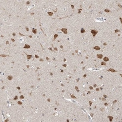 ZNF198 Antibody, Novus Biologicals:Antibodies:Primary Antibodies