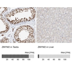 ZNF198 Antibody, Novus Biologicals:Antibodies:Primary Antibodies