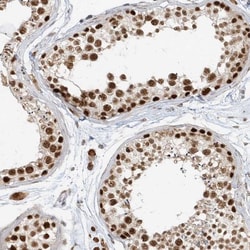 ZNF198 Antibody, Novus Biologicals:Antibodies:Primary Antibodies