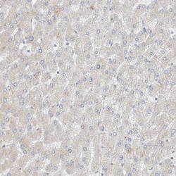 ZNF198 Antibody, Novus Biologicals:Antibodies:Primary Antibodies