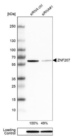 ZNF207 Antibody, Novus Biologicals 25 &mu;L; Unlabeled:Antibodies, Polyclonal