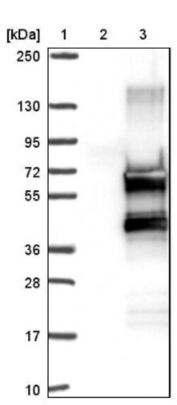 ZNF213 Antibody, Novus Biologicals 0.1 mL | Buy Online | Novus Biologicals | Fisher Scientific