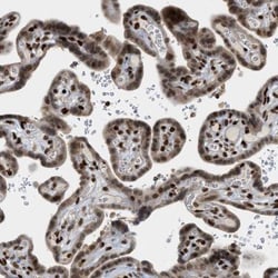 ZNF22 Antibody, Novus Biologicals:Antibodies:Primary Antibodies