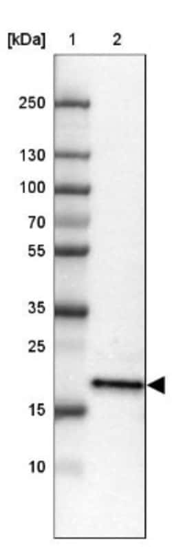 ZNF22 Antibody, Novus Biologicals:Antibodies:Primary Antibodies