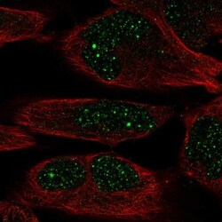 ZNF221 Antibody, Novus Biologicals 0.1mL; Unlabeled:Antibodies, Polyclonal
