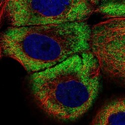 ZNF23 Antibody, Novus Biologicals 25 &mu;L; Unlabeled:Antibodies, Polyclonal