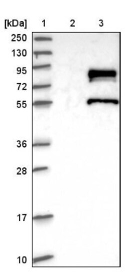 ZNF23 Antibody, Novus Biologicals 25 &mu;L; Unlabeled:Antibodies, Polyclonal