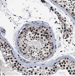 ZNF233 Antibody, Novus Biologicals 0.1mL; Unlabeled:Antibodies, Polyclonal
