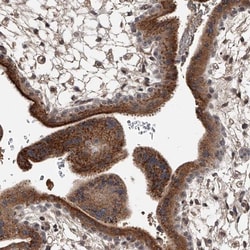 ZNF25 Antibody, Novus Biologicals:Antibodies:Primary Antibodies
