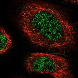 ZNF251 Antibody, Novus Biologicals:Antibodies:Primary Antibodies