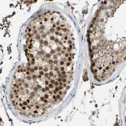 ZNF251 Antibody, Novus Biologicals:Antibodies:Primary Antibodies