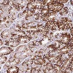 ZNF256 Antibody, Novus Biologicals 0.1mL; Unlabeled:Antibodies, Polyclonal