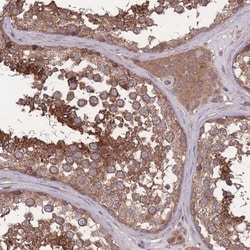 ZNF259 Antibody, Novus Biologicals 25 &mu;L, Unlabeled:Antibodies, Polyclonal