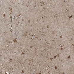 ZNF263 Antibody, Novus Biologicals 0.1mL; Unlabeled:Anticorps, Polyclonal