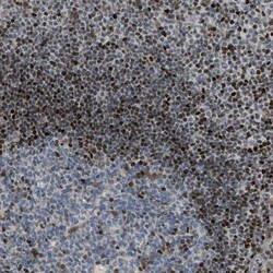 ZNF276 Antibody, Novus Biologicals 25 &mu;L; Unlabeled:Antibodies, Polyclonal