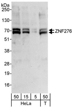 ZNF276 Antibody, Novus Biologicals 0.1mL; Unlabeled:Antibodies, Polyclonal