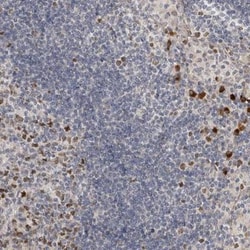 ZNF277 Antibody, Novus Biologicals 0.1mL; Unlabeled:Antibodies, Polyclonal