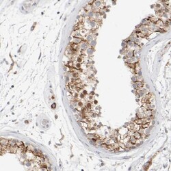 ZFP112 Antibody, Novus Biologicals 25ul | Buy Online | Novus Biologicals | Fisher Scientific