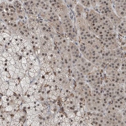 ZNF295 Antibody, Novus Biologicals 0.1mL; Unlabeled:Antibodies, Polyclonal