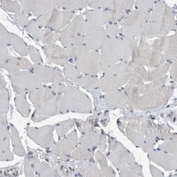 ZNF295 Antibody, Novus Biologicals 0.1mL; Unlabeled:Antibodies, Polyclonal