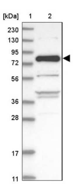 ZNF295 Antibody, Novus Biologicals 0.1mL; Unlabeled:Antibodies, Polyclonal