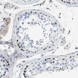 ZNF297B Antibody, Novus Biologicals 25 &mu;L, Unlabeled:Antibodies, Polyclonal