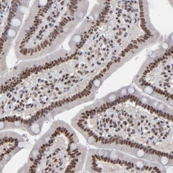 ZNF3 Antibody, Novus Biologicals 0.1mL; Unlabeled:Antibodies, Polyclonal