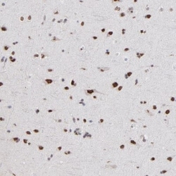 ZNF3 Antibody, Novus Biologicals 0.1mL; Unlabeled:Antibodies, Polyclonal