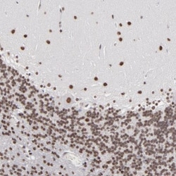 ZNF3 Antibody, Novus Biologicals 0.1mL; Unlabeled:Antibodies, Polyclonal