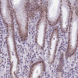 ZNF76 Antibody, Novus Biologicals:Antibodies:Primary Antibodies