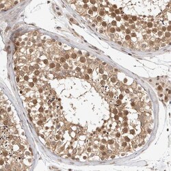 ZNF318 Antibody, Novus Biologicals:Antibodies:Primary Antibodies