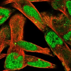 ZNF322A Antibody, Novus Biologicals 25 &mu;L, Unlabeled:Antibodies, Polyclonal