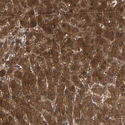 ZNF323 Antibody, Novus Biologicals 25 &mu;L; Unlabeled:Antibodies, Polyclonal