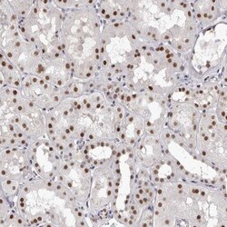 ZNF326 Antibody, Novus Biologicals 0.1mL; Unlabeled:Antibodies, Polyclonal