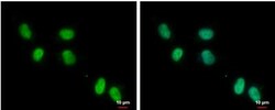 ZNF329 Antibody, Novus Biologicals 0.1mL; Unlabeled:Antibodies, Polyclonal