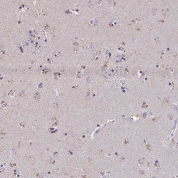 ZNF34 Antibody, Novus Biologicals 0.1mL; Unlabeled:Antibodies, Polyclonal