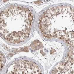 ZNF341 Antibody, Novus Biologicals 25 &mu;L; Unlabeled:Antibodies, Polyclonal