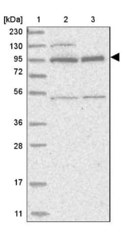 ZNF341 Antibody, Novus Biologicals 25 &mu;L; Unlabeled:Antibodies, Polyclonal