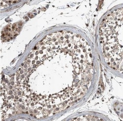 ZNF345 Antibody, Novus Biologicals 25 &mu;L; Unlabeled:Antibodies, Polyclonal